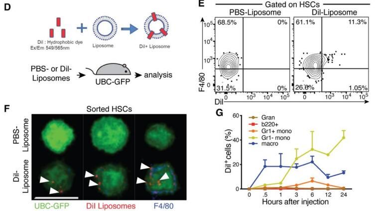 Dil-Liposomes